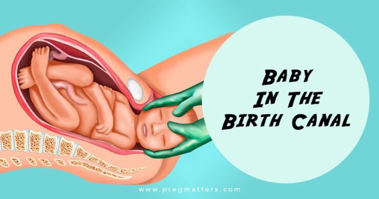 Normal vaginal delivery