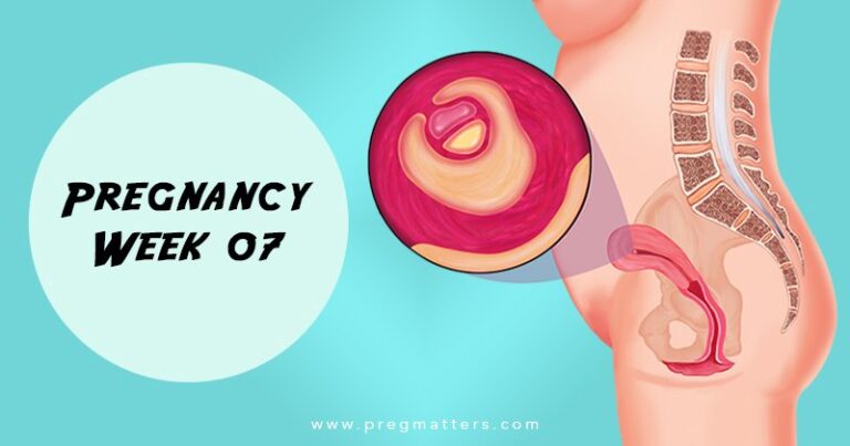 7 Weeks Pregnant