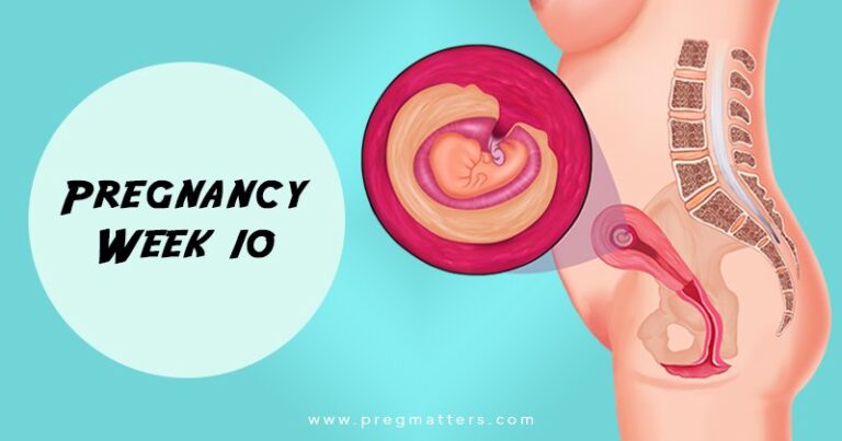 10 Weeks Pregnant